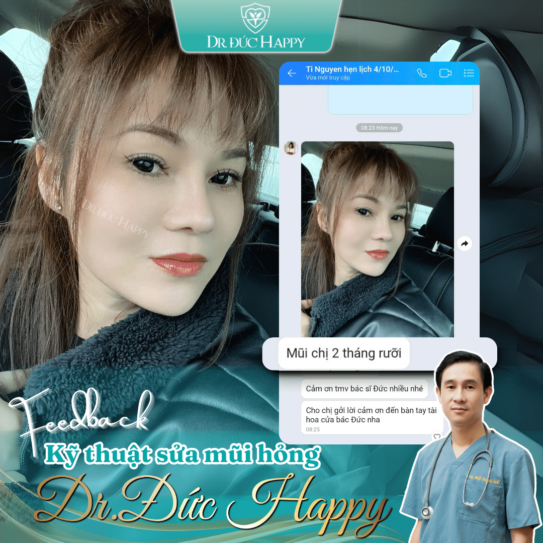 Review bác sĩ nâng mũi giỏi