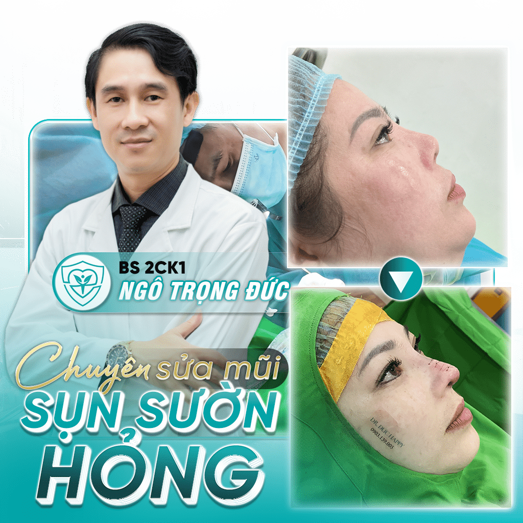 dr duc happy chuyên sửa mũi sụn sườn hỏng