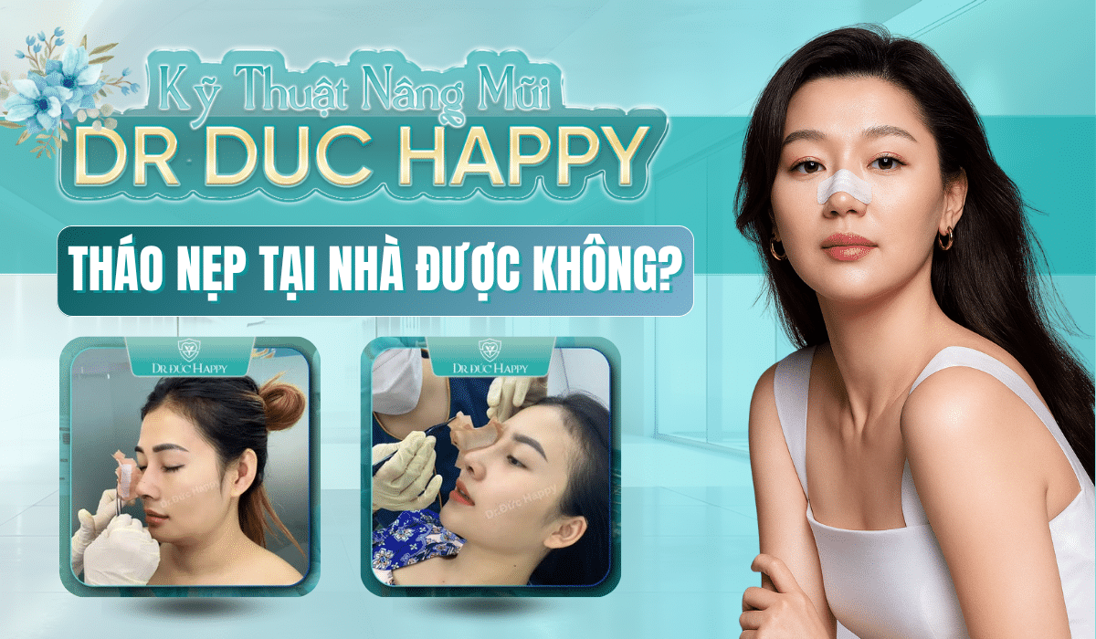 nâng mũi vi phẫu tháo nẹp tại nhà được không?