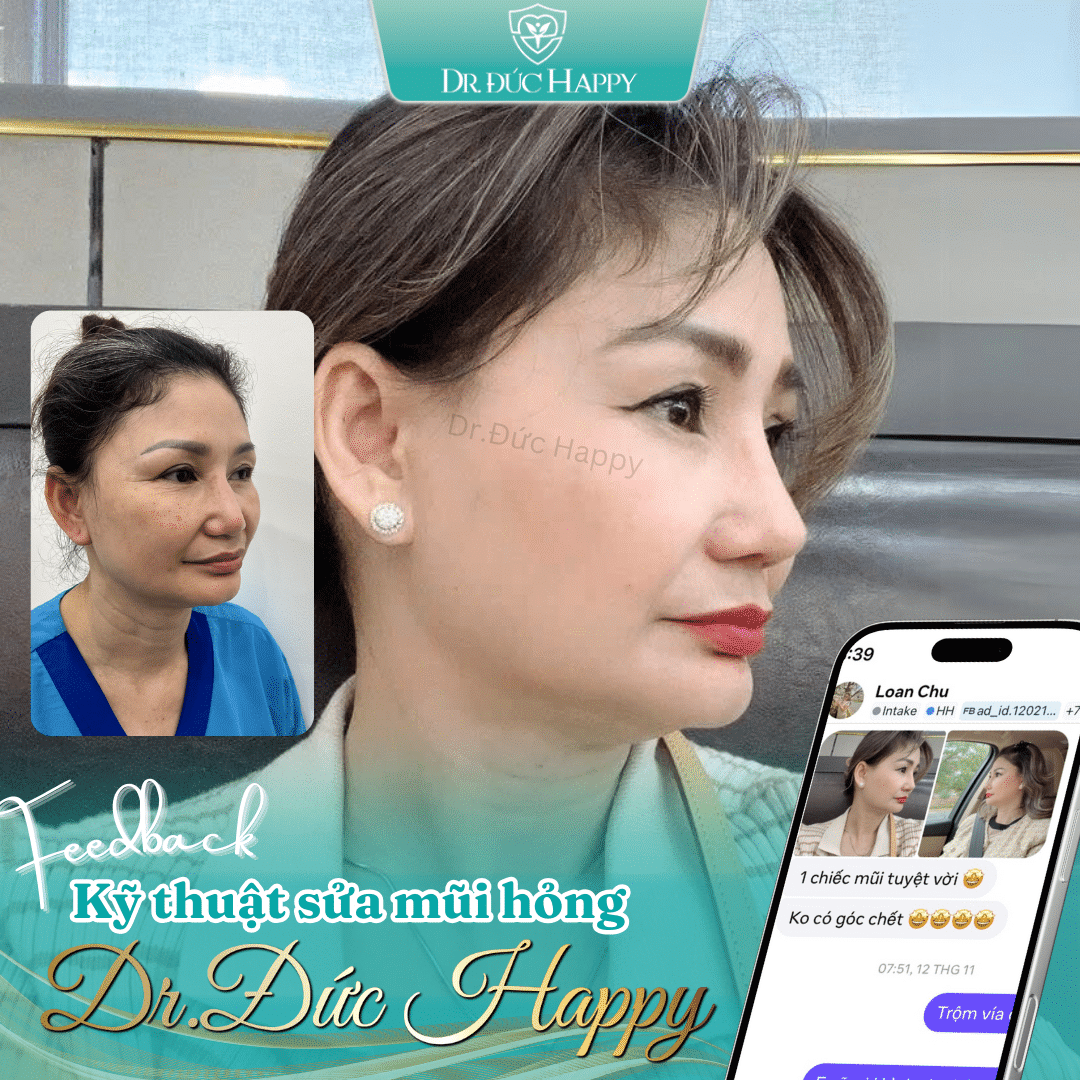 Khách Việt kiều sửa mũi với BS Ngô Trọng Đức tại TPHCM