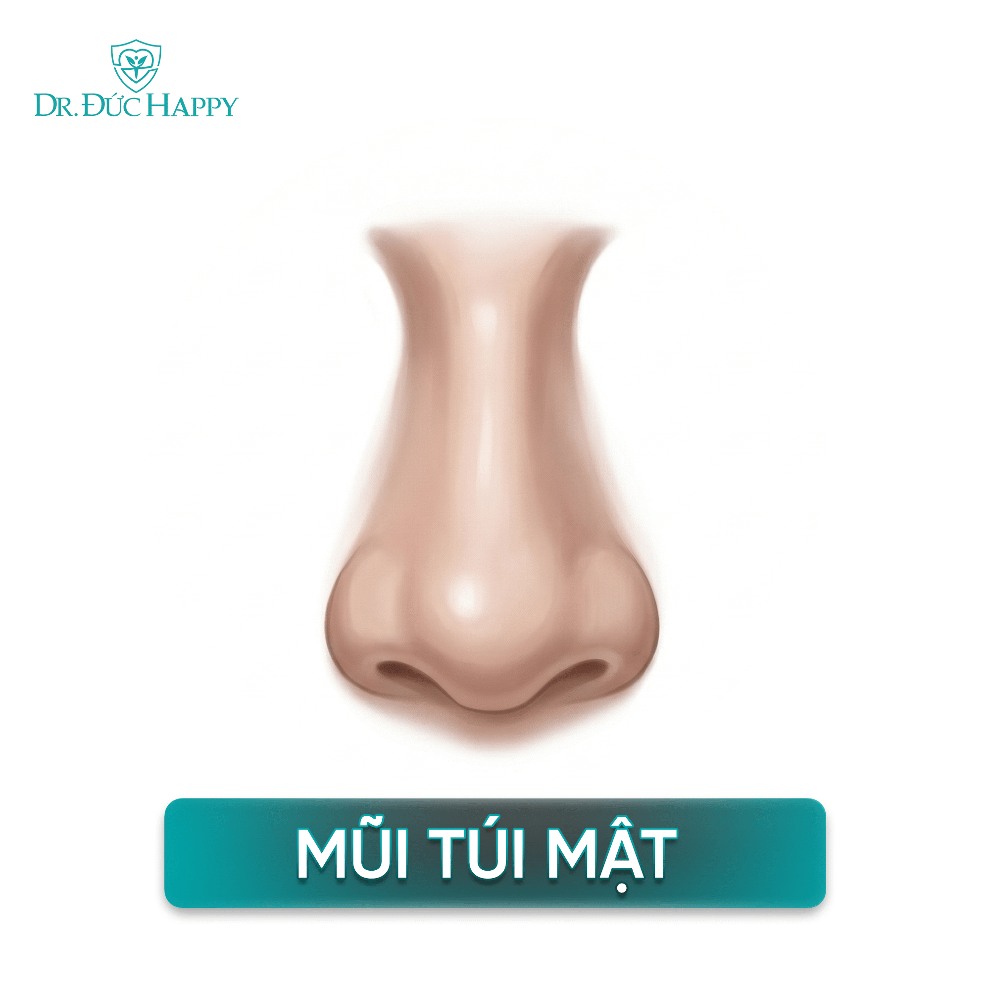 dáng mũi túi mật