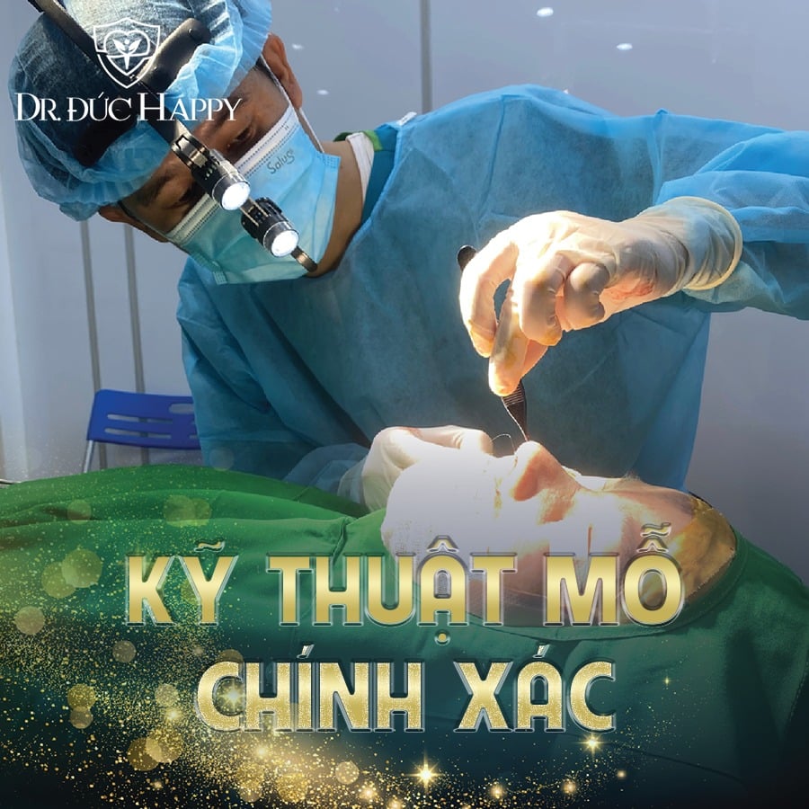 Kỹ thuật nâng mũi Dr. Đức Happy - Ứng dụng vi phẫu