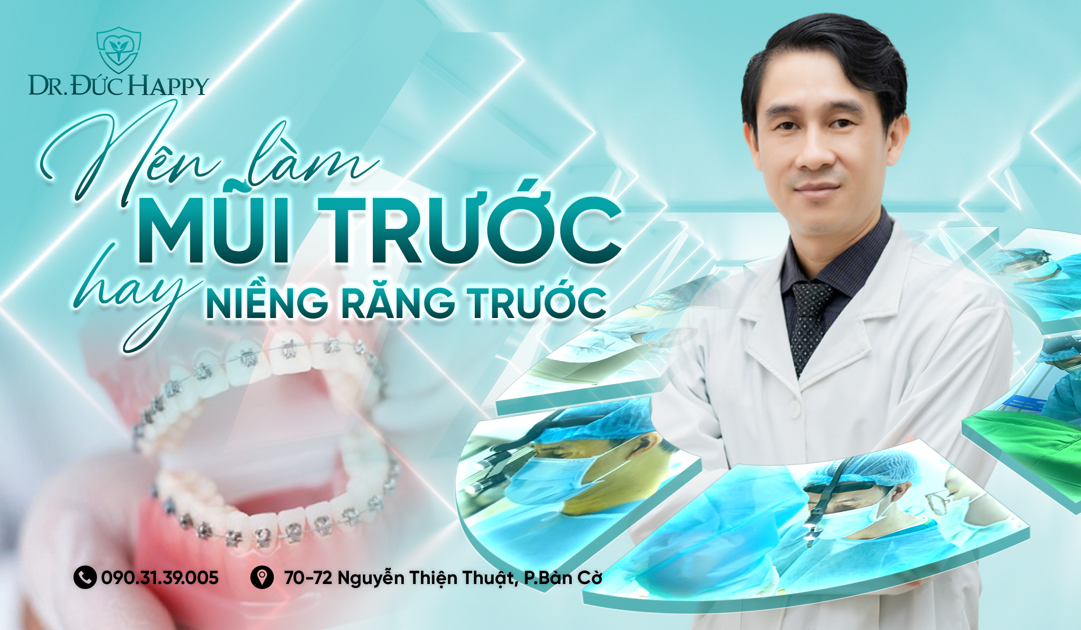 nên làm mũi trước hay niềng răng trước