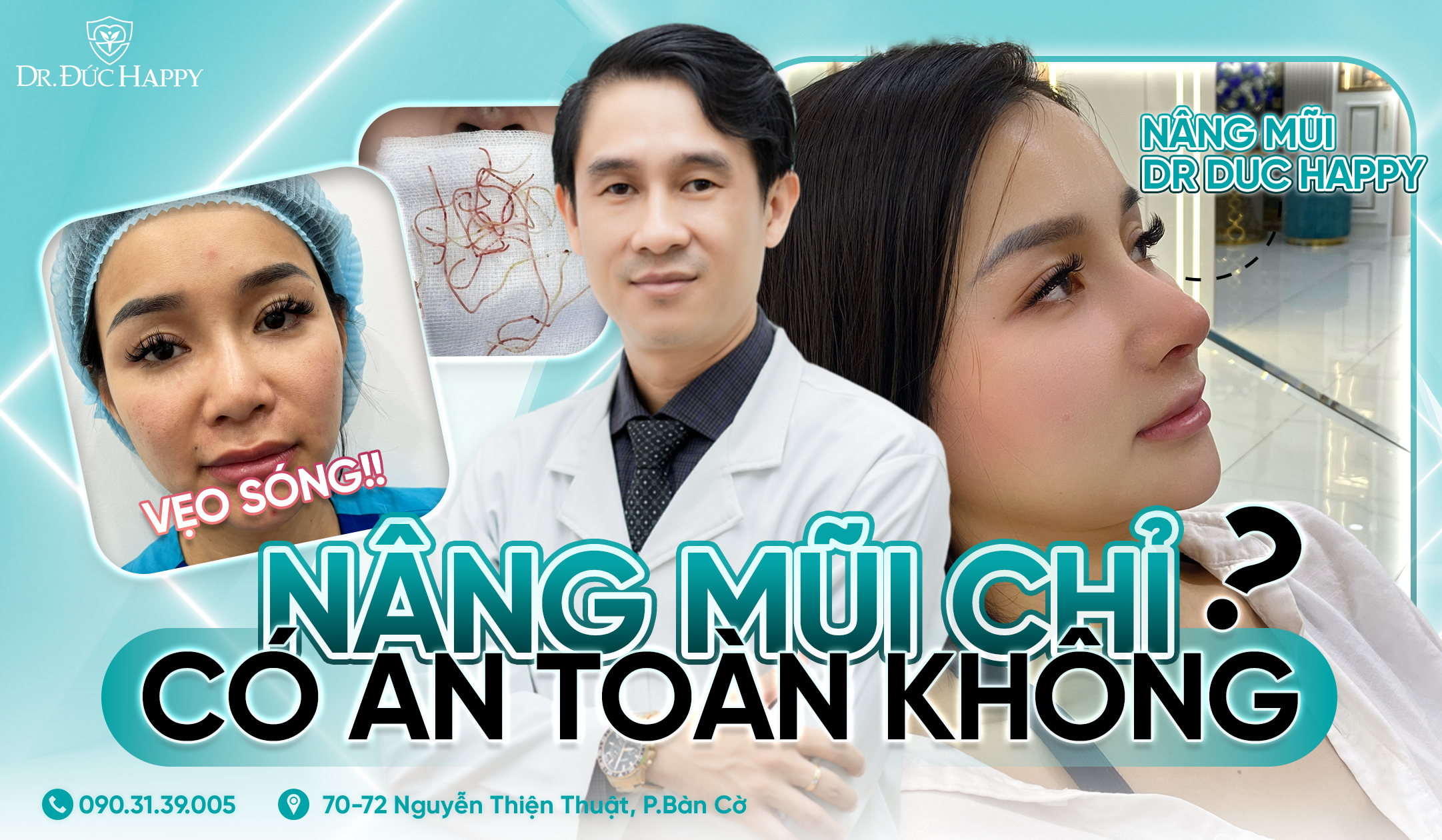 Nâng mũi chỉ có an toàn không