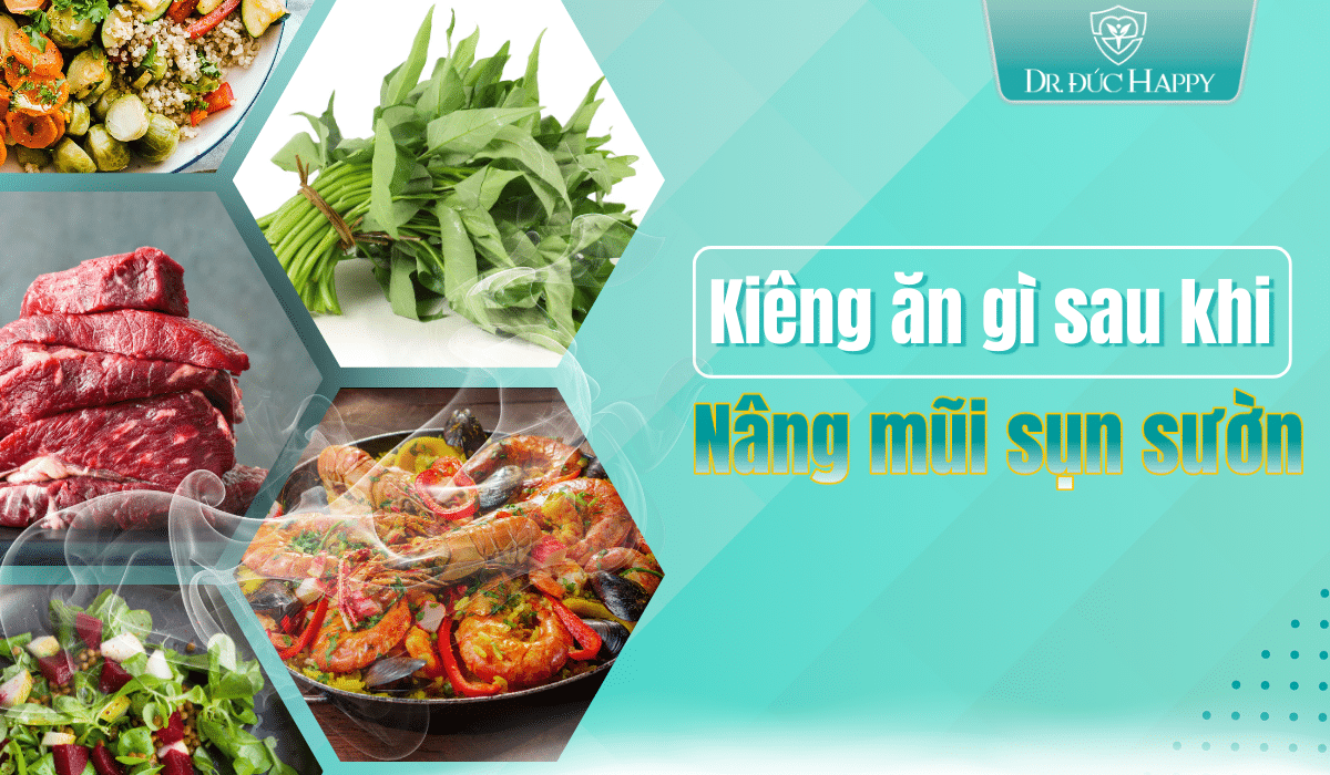 nâng mũi sụn sườn kiêng ăn gì?