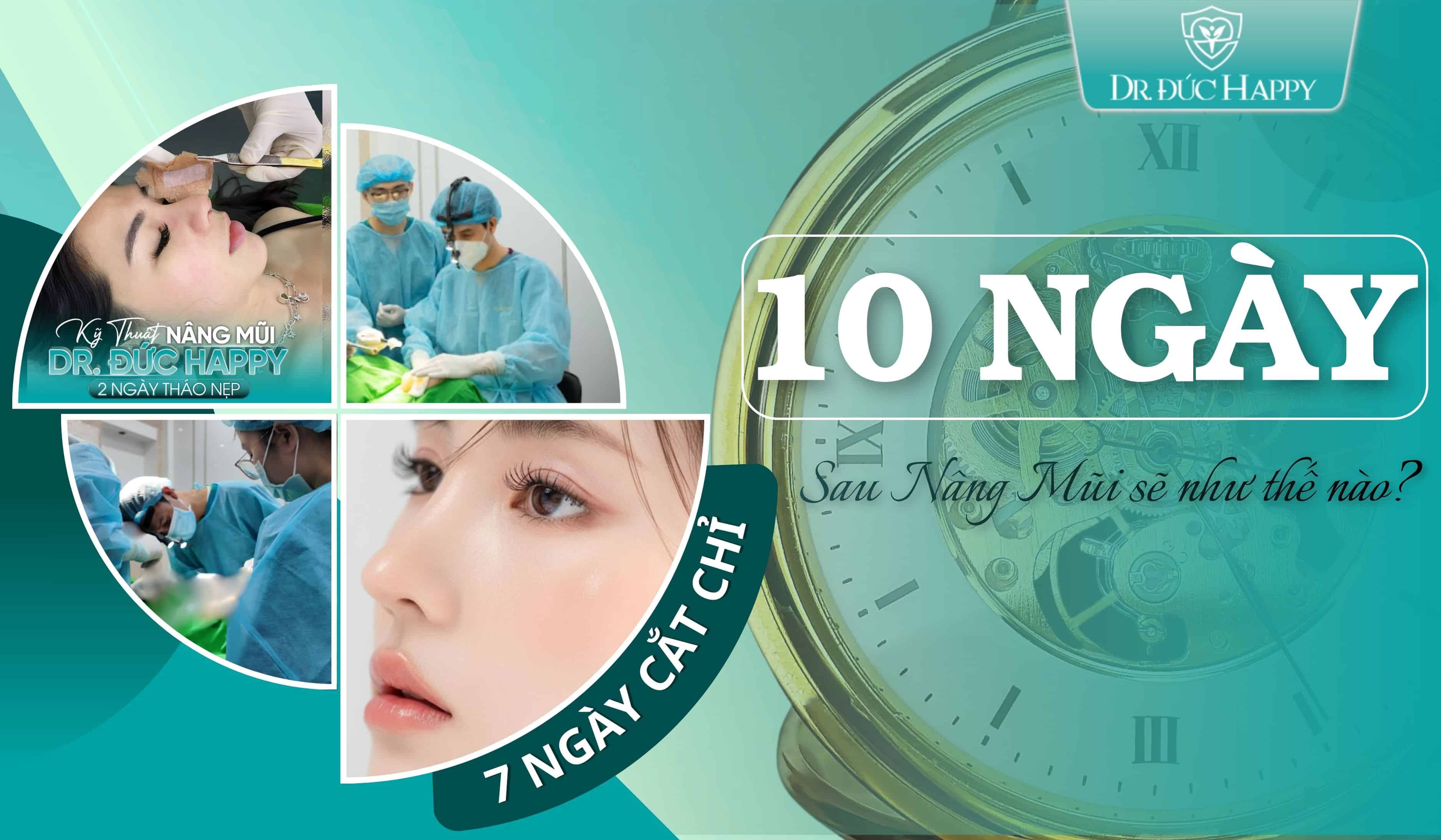 10 Ngày sau nâng mũi sẽ như thế nào