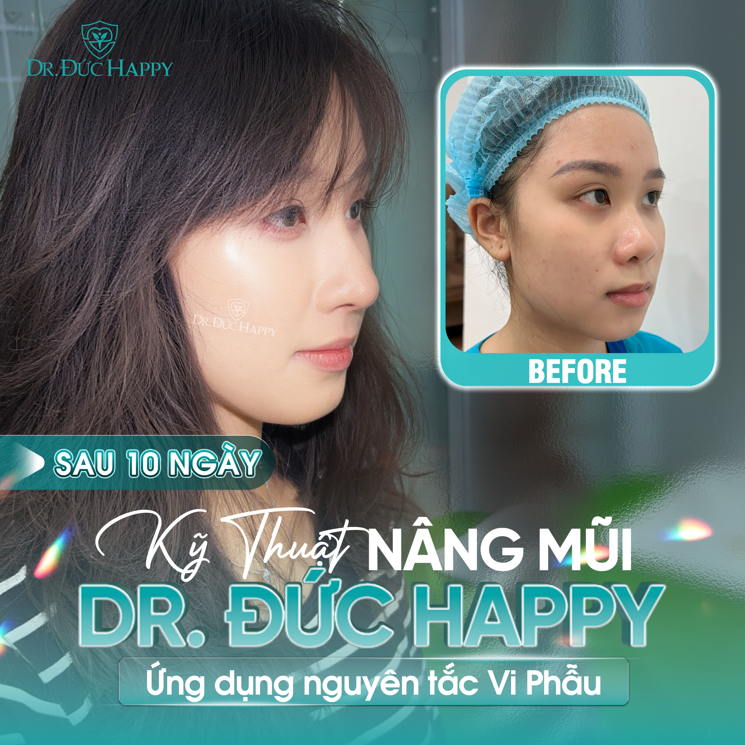 Quá trình lành thương ở mỗi người là khác nhau - 10 Ngày Cắt Chỉ