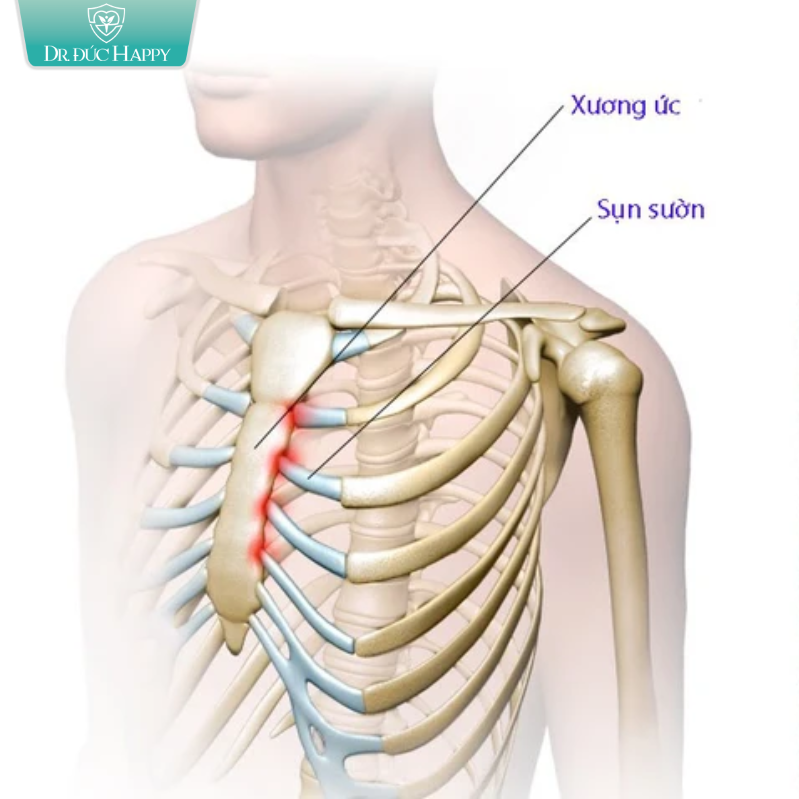 nâng mũi sụn sườn có đau không?