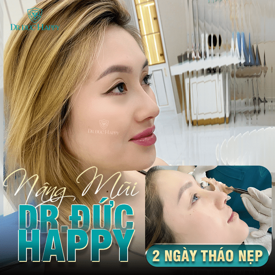 Nâng mũi ứng dụng vi phẫu Dr. Đức Happy