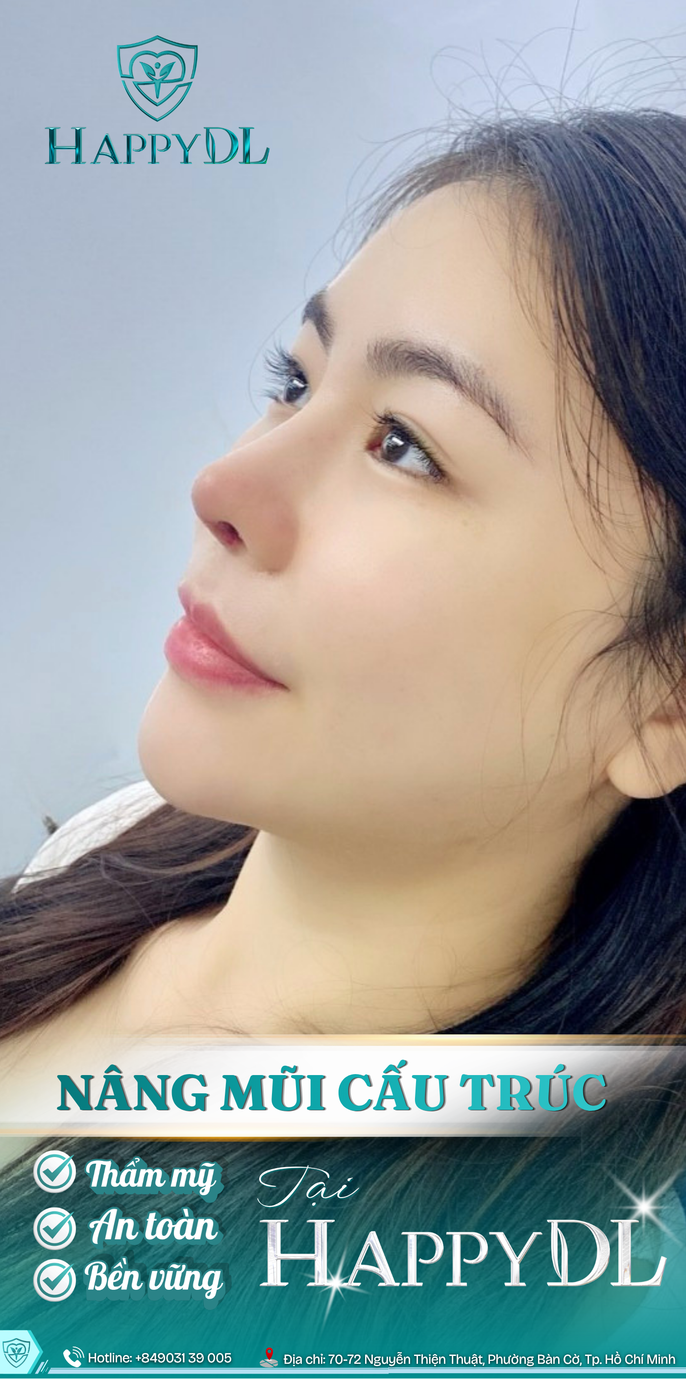 Nâng mũi cấu trúc tại HappyDL