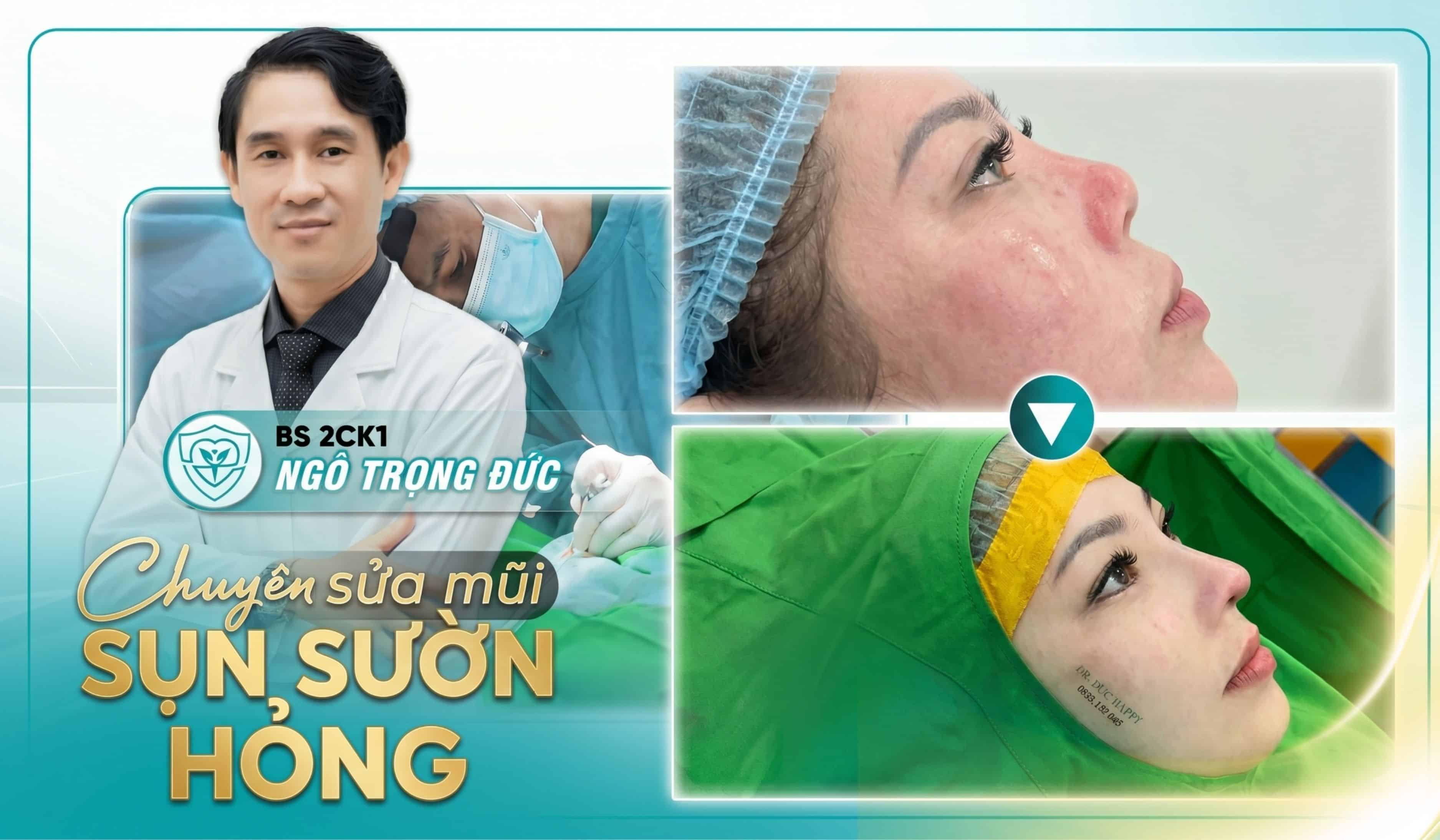 sua-mui-hong-co-bat-buoc-dung-sun-suon-khong