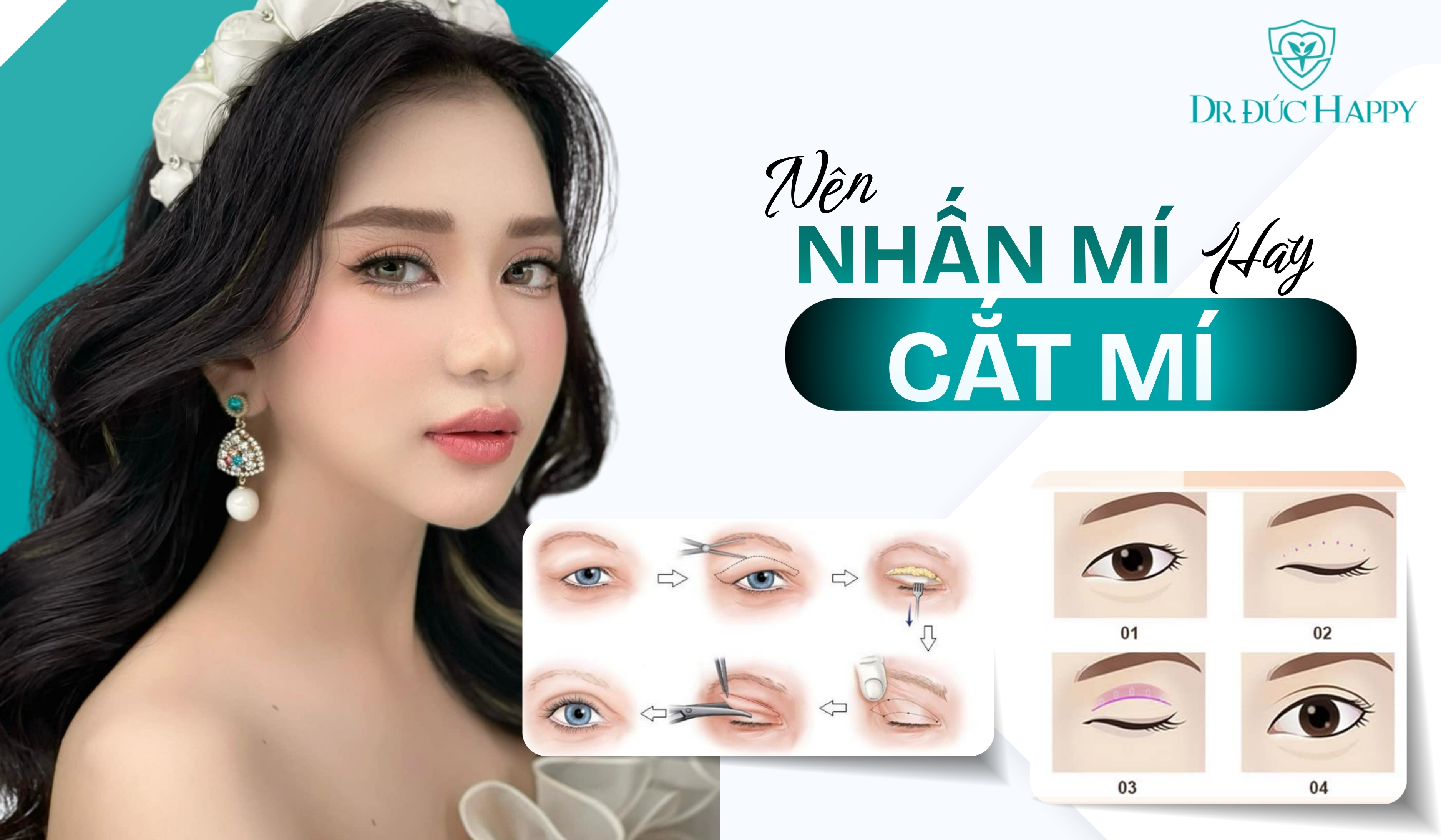 Nên cắt mí hay nhấn mí