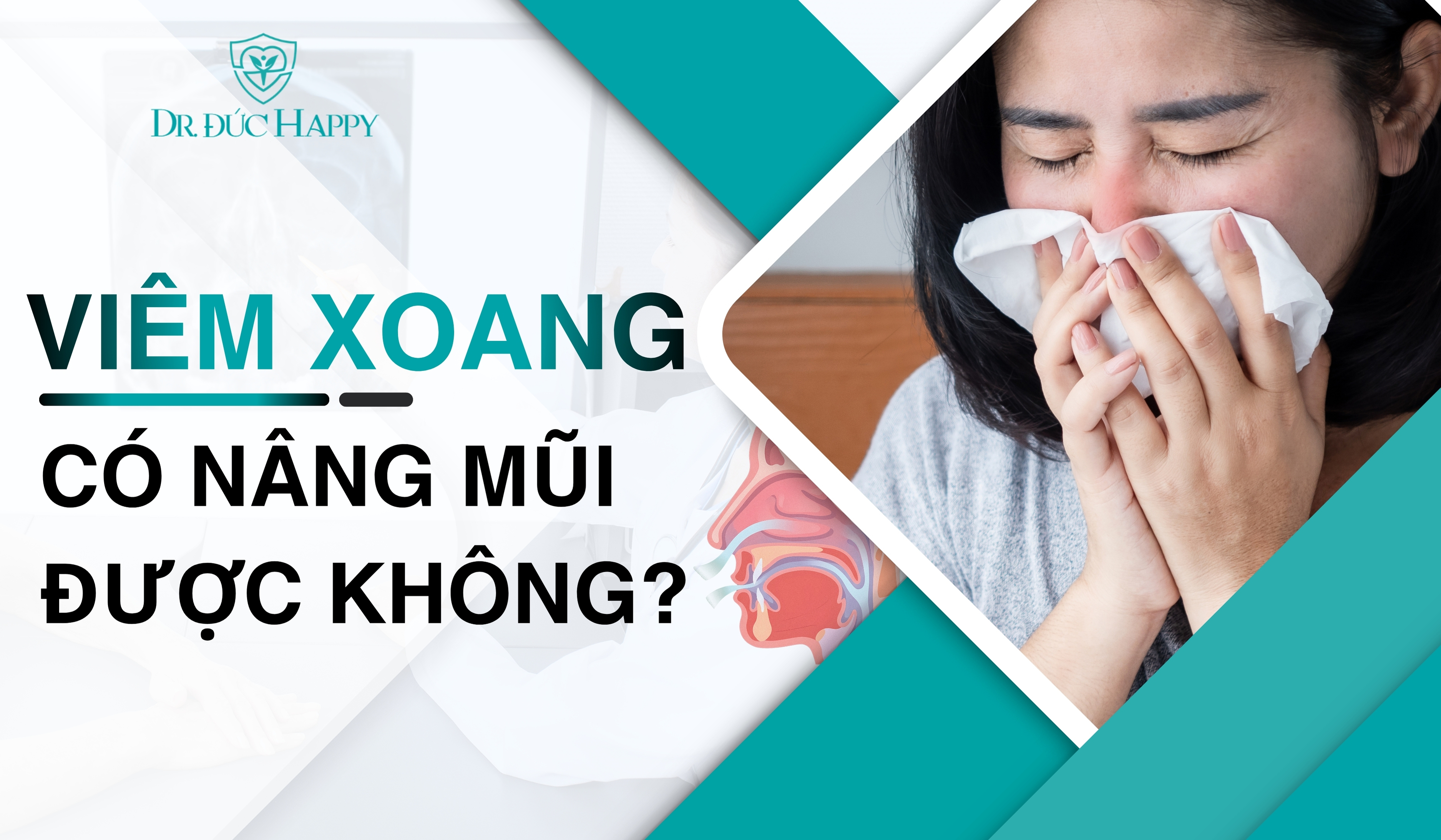 Viêm xoang có được nâng mũi không?