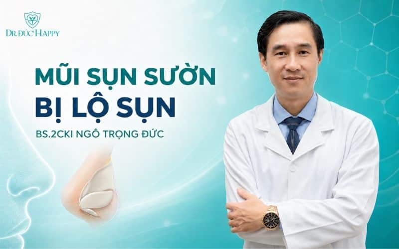 Mũi sụn sườn bị lộ sụn