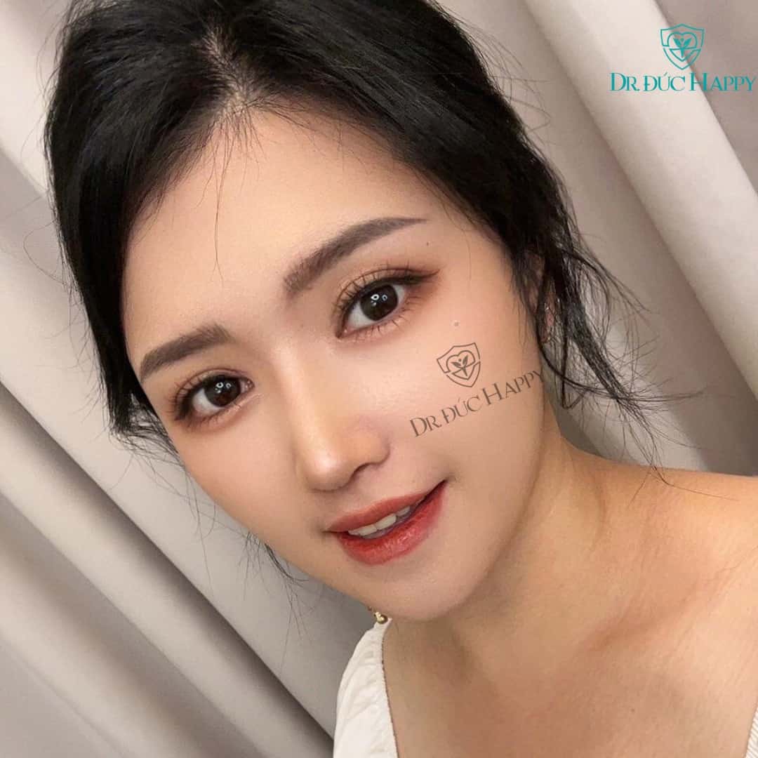 bác sĩ nâng mũi đẹp tại Sài Gòn