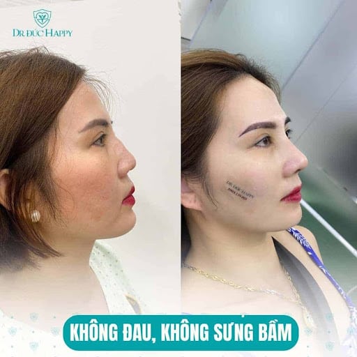 bac-si-nao-sua-mui-dep-thanh-pho-ho-chi-minh